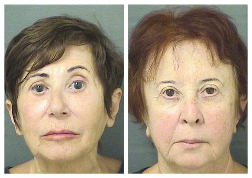 Maya Grinberg, 71, and Marina Kuralesina, 73. (Photos: Palm Beach County Jail)